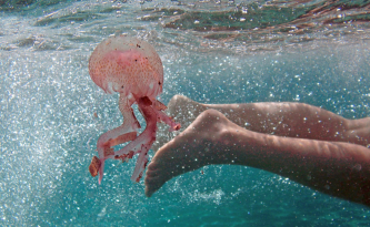 Morso di medusa: consigli e rimedi
