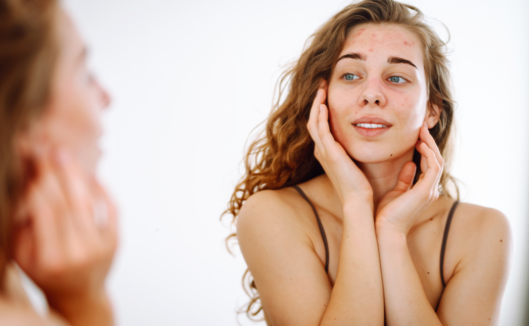 Pelle secca in inverno: cause, rimedi e prodotti da usare