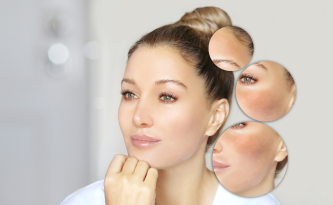 Pelle in primavera: come prepararla al sole